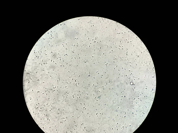 Visão no esperma humano sob microscópio em laboratório — Fotografia de Stock