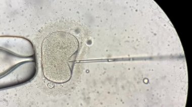 İn vitro fertilizasyon sürecinde mikroskop üzerinden görünüm