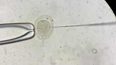 İn vitro fertilizasyon sürecinde mikroskop üzerinden görünüm