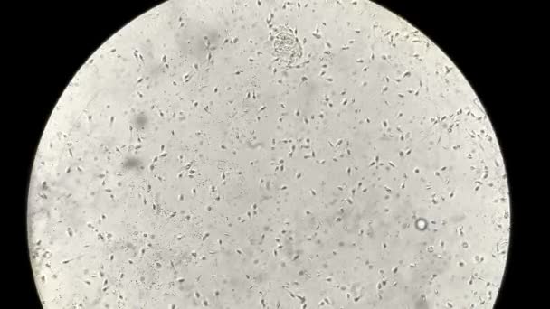 Просмотр спермы человека под микроскопом в лаборатории — стоковое видео