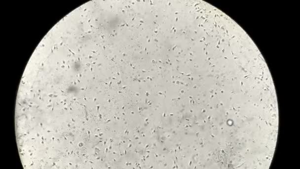 Vista allo sperma umano al microscopio in laboratorio — Video Stock