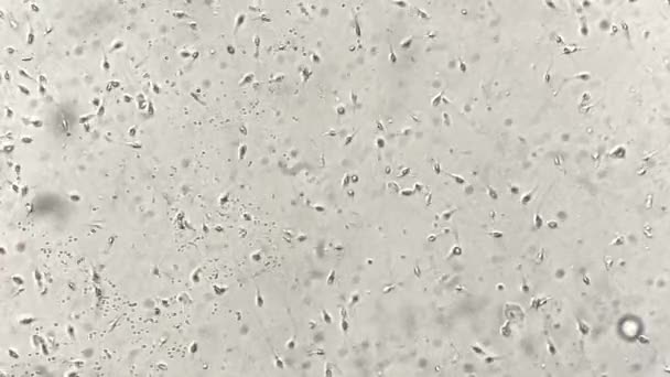 実験室で顕微鏡下のヒト精子で見る — ストック動画