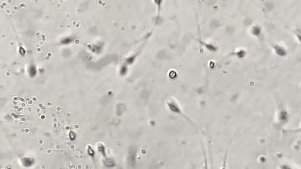 Vista al esperma humano bajo el microscopio en el laboratorio — Vídeos de Stock