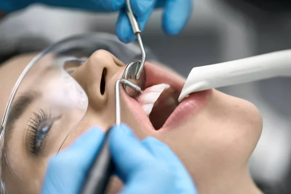 Pretty kvinnans tänder rengöring i Dental Clinic — Stockfoto