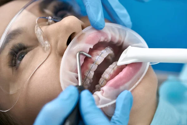 Pretty kvinnans tänder rengöring i Dental Clinic — Stockfoto