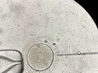 İn vitro fertilizasyon sürecinde mikroskop üzerinden görünüm