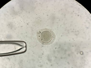 İn vitro fertilizasyon sürecinde mikroskop üzerinden görünüm