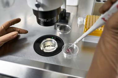 Laboratuvarda in vitro fertilizasyon süreci