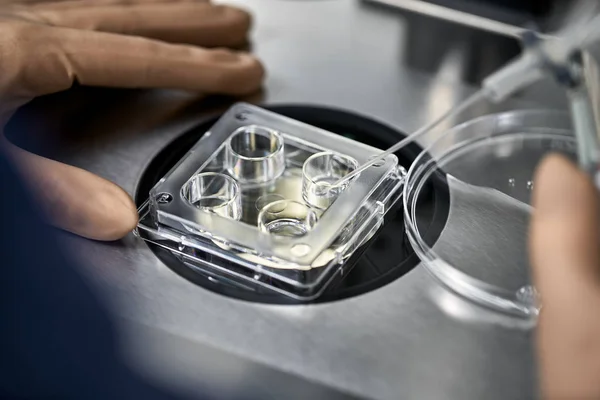 Processo di fecondazione in vitro in laboratorio — Foto Stock