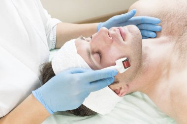 Adam bir modern tıbbi alet derma roller ile tıbbi mikro iğne tedavisinin yordamı geçer.