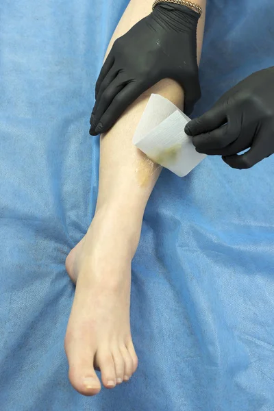 Process Depilation Female Legs Hands Beauty Salon — Stock Photo, Image