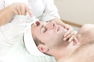 Adam bir modern tıbbi alet derma roller ile tıbbi mikro iğne tedavisinin yordamı geçer. 