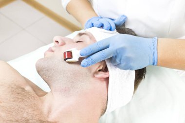 Adam bir modern tıbbi alet derma roller ile tıbbi mikro iğne tedavisinin yordamı geçer.