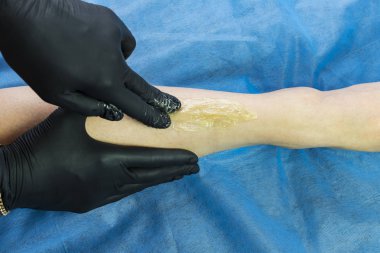 Güzellik salonunda kadın bacakları ve elleri inceleniyor. 