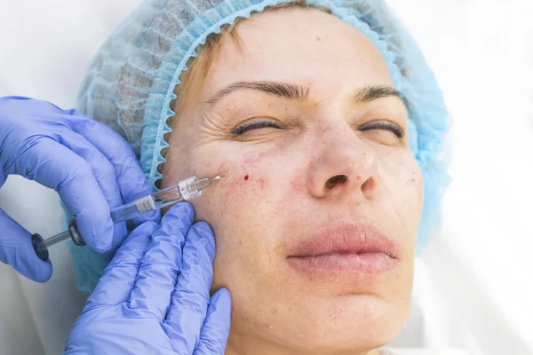 Schönheitschirurgie Medizinische Behandlung Einer Erwachsenen Frau Einer Kosmetischen Klinik — Stockfoto