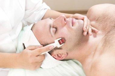 Adam bir modern tıbbi alet derma roller ile tıbbi mikro iğne tedavisinin yordamı geçer. 