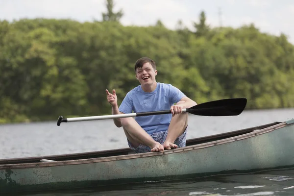 Joven Feliz Con Síndrome Remando Una Canoa Lago — Foto de Stock