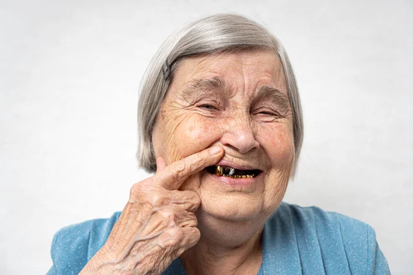 Toothless elderly woman. Happy old age concept with a cheerful smiling aged woman without teeth.