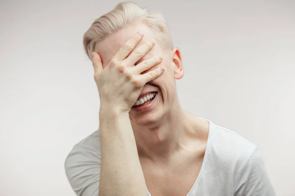 Closeup of upset overwhelmed young man covering his face with hand with dispair — Stock Photo, Image