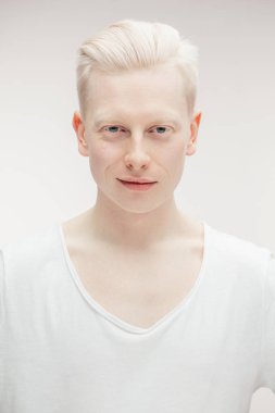 Beyaz arka planda siyah tişörtlü albino adam izole edilmiş..