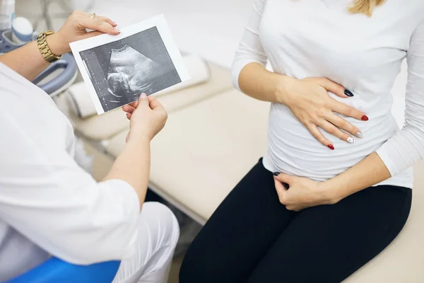 妊娠中の女性医師を示す超音波写真 — ストック写真