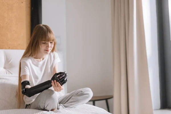 Красива дівчина дивиться на її протезну руку, сидячи на ліжку — стокове фото