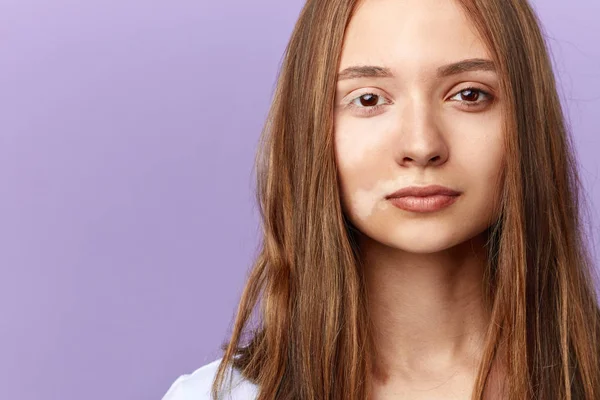 Awesome girl before the surgery, operation — Stock Photo, Image