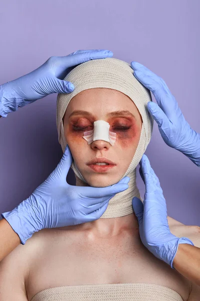 Doctors analizing , checking the womans bruises on the face — Stock Photo, Image