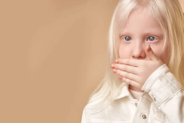 Menina estranha com aparência incomum, conceito alienígena. albino — Fotografia de Stock