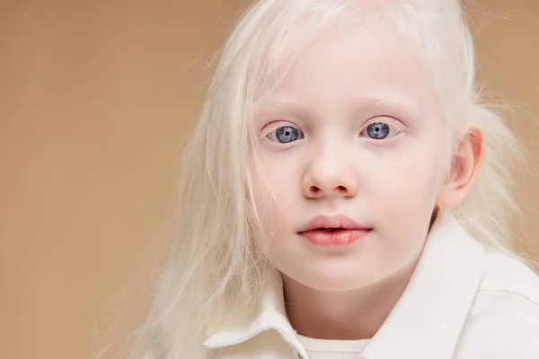 백색증 증후군 이 있는 어린 소녀 의사 진 — 스톡 사진