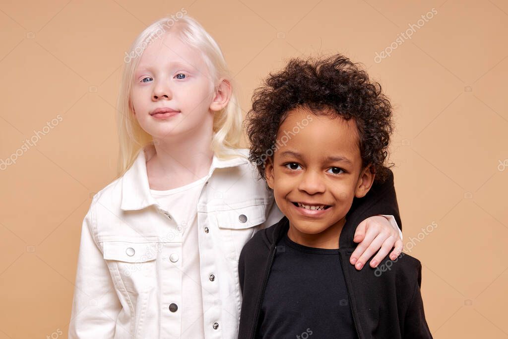 two friendly african and albino children stand together