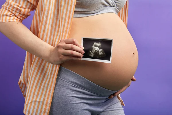 Έγκυος γυναίκα ακτινοβολούν με χαρά κατέχει υπερηχογράφημα μπροστά από το στρογγυλό κοιλιά — Φωτογραφία Αρχείου