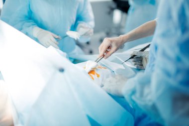 Torunlu makas tutan eldivenli surgon