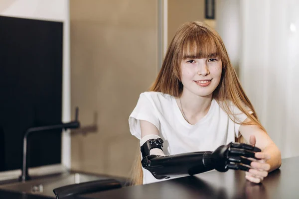 Sonriente chica impresionante con brazo artificial mirando a la cámara — Foto de Stock