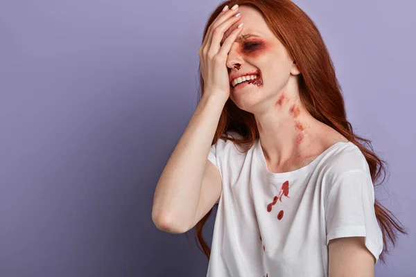 Weinendes Mädchen bekam während eines Streits mit ihrem Freund einen Schienbeinbruch — Stockfoto