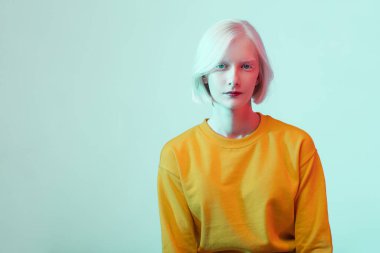 Beyaz tenli, doğal dudaklı ve beyaz saçlı güzel albino kız.
