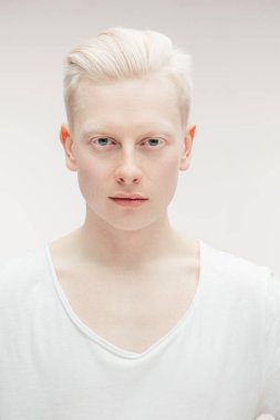 Beyazda izole edilmiş model erkek. Yakışıklı albino adam, yakın çekim..