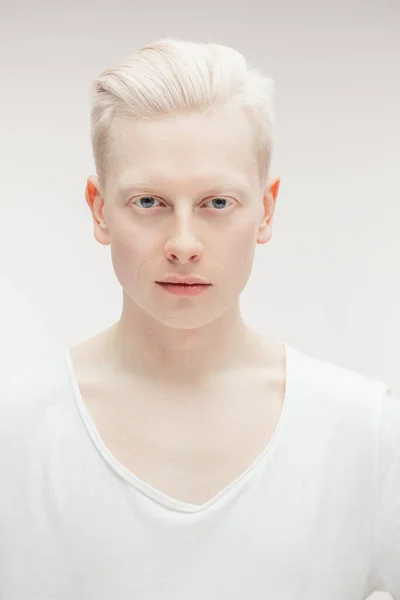 Modèle de mode mâle isolé sur blanc. beau albinos gars gros plan. — Photo