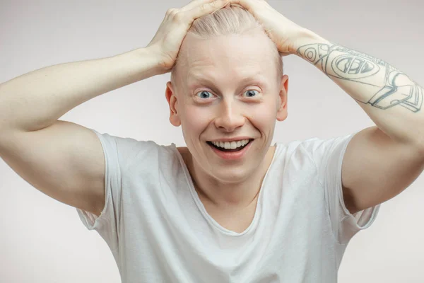 Emozionale felice sorpreso Albino modello maschile con gli occhi cimici e bocca aperta. — Foto Stock