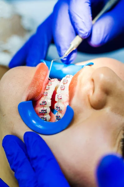Female patient at dental procedure using dental drill