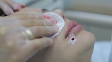 Güzellik uzmanı spa Güzellik Salonu akne tedavisi mekanik aleti kullanarak yapıyor. Kavramı tıbbi tedavi gençleştirme ve Cilt Bakımı.