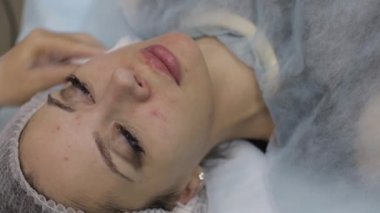 Akne siyah nokta çıkarıcı. Kadın yüzü, Güzellik Kliniği.