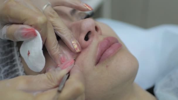 Cosmetologue au salon de beauté spa faisant le traitement de l'acné à l'aide d'un instrument mécanique. Concept de rajeunissement du traitement médical et de soins de la peau . — Video