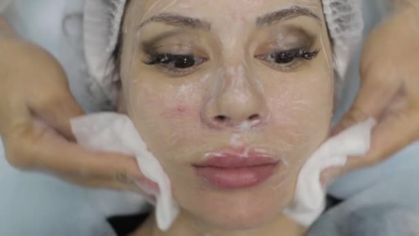 L'acné dissolvant pour points noirs. Visage féminin, clinique de beauté . — Video