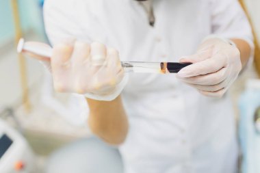 Kan plazması şırıngasında test tüpünden alınan kan plazmasının hazırlanması..