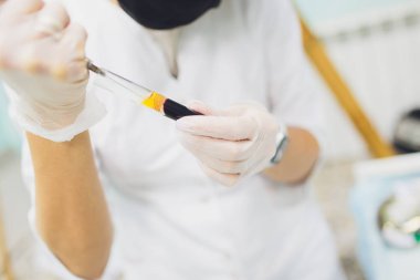 Kan plazması şırıngasında test tüpünden alınan kan plazmasının hazırlanması..