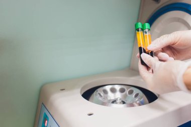 Test tüpleri ile kan ile tıbbi laboratuar santrifüj.