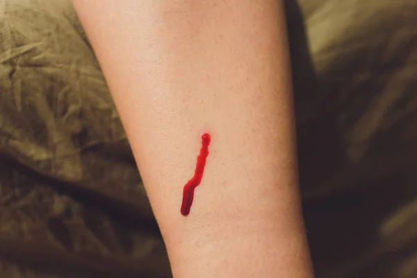 Un'iniezione. Trattamento. Sangue umano. Malattie del sangue. Donatore. Il sangue rosso scorre dalla ferita. Un morso di un insetto. Esami del sangue. Clinica e diagnostica. Medicina. Corpo umano . — Foto Stock