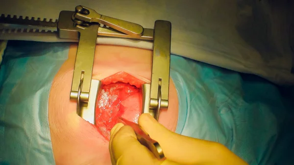 Врач проводит операцию по пересадке сердца — стоковое фото