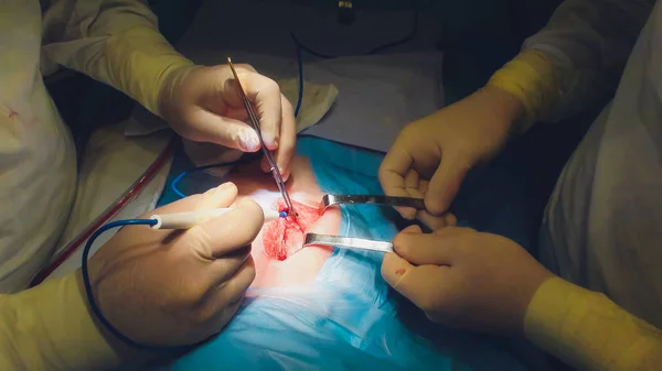 Détail d'une opération chirurgicale dans la salle d'opération d'un hôpital . — Photo